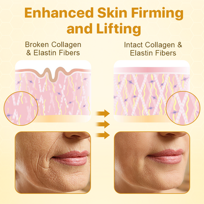🔥 LAST DAY SALE-80%OFF 🔥 - BotoxLux Lift Cream